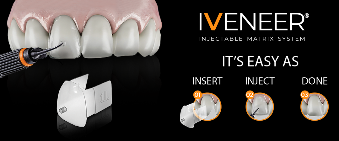 IVENEER Injectable Matrix System