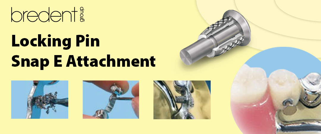 Bredent Locking Pin Snap E Attachment