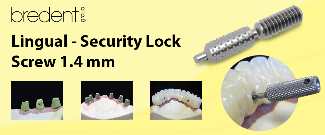 Bredent Lingual - Security Lock Screw 1.4 mm