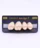 NEO LIGN P TOOTH POST 1G3 UPPER A1 4 pc