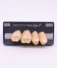 NEO LIGN P TOOTH POST 1G3 UPPER A3 4 pc