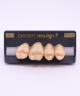 NEO LIGN P TOOTH POST 1G3 UPPER A3.5 4 pc