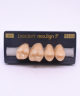 NEO LIGN P TOOTH POST 1G3 UPPER A4 4 pc