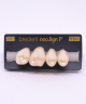 NEO LIGN P TOOTH POST 1G3 UPPER B1 4 pc