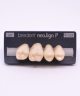 NEO LIGN P TOOTH POST 1G3 UPPER B2 4 pc