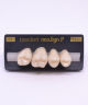 NEO LIGN P TOOTH POST 1G3 UPPER C1 4 pc