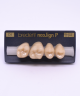 NEO LIGN P TOOTH POST 1G3 UPPER C4 4 pc