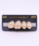 NEO LIGN P TOOTH POST 1G3 UPPER D2 4 pc