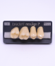 NEO LIGN P TOOTH POST 1G3 UPPER D4 4 pc