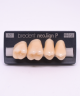 NEO LIGN P TOOTH POST 1G4 UPPER A3 4 pc