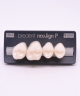 NEO LIGN P TOOTH POST 1G4 UPPER BL3 4 pc