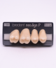 NEO LIGN P TOOTH POST 1G4 UPPER D3 4 pc