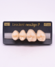 NEO LIGN P TOOTH POST 2G3 UPPER A2 4 pc