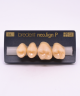 NEO LIGN P TOOTH POST 2G3 UPPER B4 4 pc