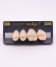 NEO LIGN P TOOTH POST 2G3 UPPER C1 4 pc