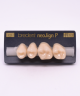 NEO LIGN P TOOTH POST 2G3 UPPER C2 4 pc