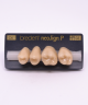 NEO LIGN P TOOTH POST 2G3 UPPER C4 4 pc