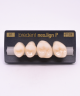 NEO LIGN P TOOTH POST 2G4 UPPER B1 4 pc