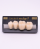 NEO LIGN P TOOTH POST 3G3 LOWER A1 4 pc