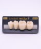 NEO LIGN P TOOTH POST 3G3 LOWER B1 4 pc