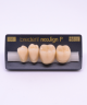 NEO LIGN P TOOTH POST 3G3 LOWER B3 4 pc