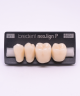 NEO LIGN P TOOTH POST 3G4 LOWER A1 4 pc