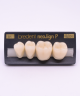 NEO LIGN P TOOTH POST 3G4 LOWER B1 4 pc