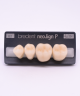 NEO LIGN P TOOTH POST 3G4 LOWER B2 4 pc