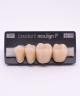 NEO LIGN P TOOTH POST 3G4 LOWER D3 4 pc