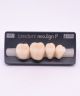 NEO LIGN P TOOTH POST 4G3 LOWER A1 4 pc