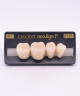 NEO LIGN P TOOTH POST 4G3 LOWER B1 4 pc