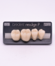 NEO LIGN P TOOTH POST 4G3 LOWER C1 4 pc