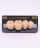 NEO LIGN P TOOTH POST 4G4 LOWER A3 4 pc