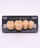 NEO LIGN P TOOTH POST 4G4 LOWER B4 4 pc