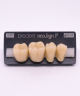 NEO LIGN P TOOTH POST 4G4 LOWER D4 4 pc