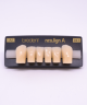 NEO LIGN A TOOTH POST D41 LOWER A2 6 pc