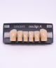 NEO LIGN A TOOTH POST D41 LOWER D3 6 pc