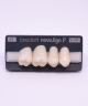 NOVO LIGN P VENEER POST G3 UPPER A1 4 pc