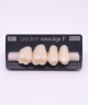 NOVO LIGN P VENEER POST G3 UPPER B1 4 pc