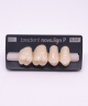 NOVO LIGN P VENEER POST G3 UPPER C1 4 pc