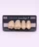 NOVO LIGN P VENEER POST G3 UPPER C3 4 pc