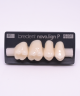 NOVO LIGN P VENEER POST G4 UPPER B1 4 pc