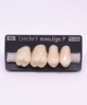 NOVO LIGN P VENEER POST G4 UPPER B2 4 pc