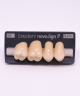 NOVO LIGN P VENEER POST G4 UPPER B3 4 pc