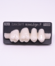 NOVO LIGN P VENEER POST G4 UPPER BL3 4 pc