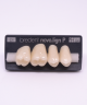 NOVO LIGN P VENEER POST G4 UPPER C1 4 pc