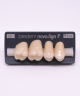 NOVO LIGN P VENEER POST G4 UPPER C2 4 pc