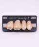 NOVO LIGN P VENEER POST G4 UPPER D2 4 pc