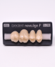 NOVO LIGN P VENEER POST 1W3 UPPER A3.5 4 pc