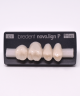 NOVO LIGN P VENEER POST 1W3 UPPER C1 4 pc